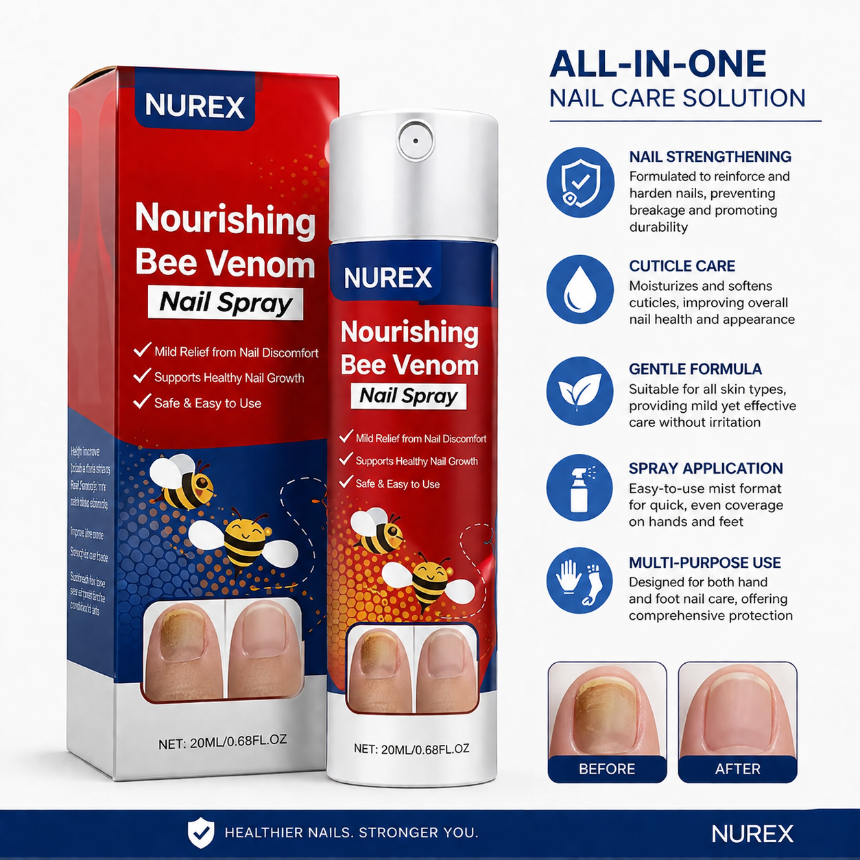 Nurex® All-in-One Nail Care Spray